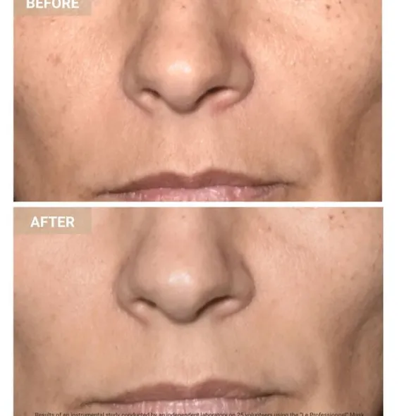 Anti-Aging LED Face Mask The Professional - Anti-aging LED-ansiktsmask