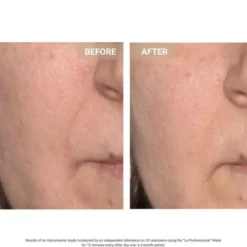 Anti-Aging LED Face Mask The Professional - Anti-aging LED-ansiktsmask