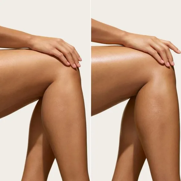 Body Badalada Vitamin-Infused Lotion 62 - Lätt återfuktande lotion