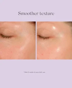 Daily Resurfacing Peel