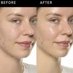 Ectoin Hydro-Barrier Serum - Återfuktande och skyddande serum