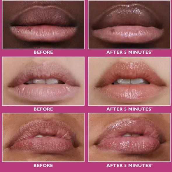 Peter Thomas Roth Instant FIRMx® Lip Filler 10 ml