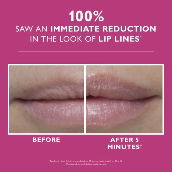 Peter Thomas Roth Instant FIRMx® Lip Filler 10 ml