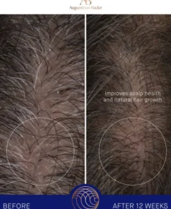 The Leave-In Hair Treatment