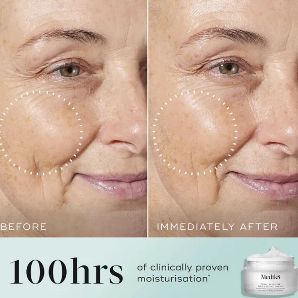 Total Moisture Daily Facial Cream